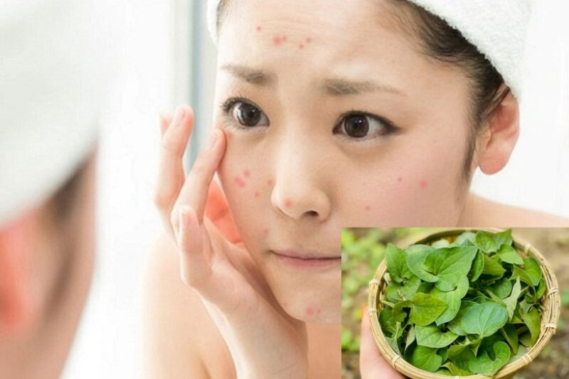 Trị mụn bằng rau diếp cá nguyên chất